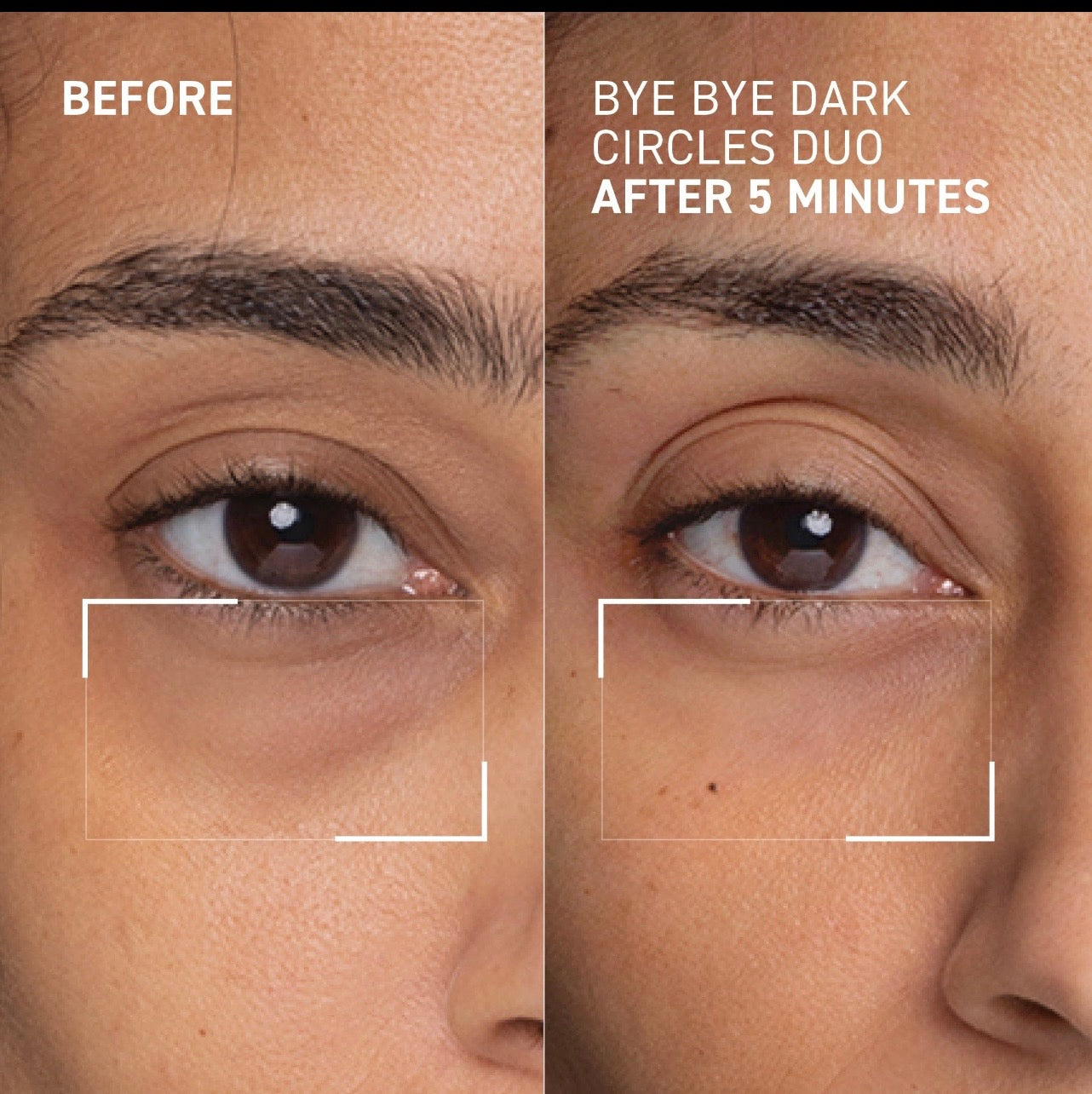 Dr. Melaxin Under-Eye Repair Cream